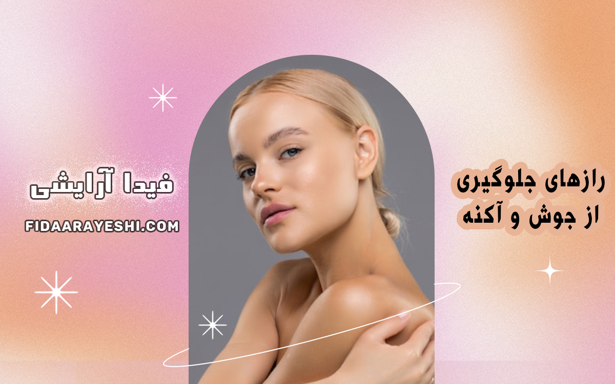 رازهای جلوگیری از جوش و آکنه با محصولات آرایشی مناسب